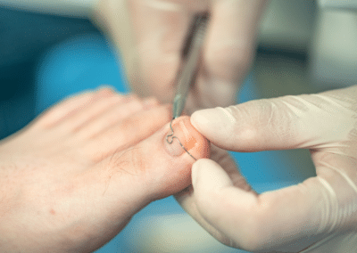 Multi-Clinic Podiatry Business for Sale in Greater London (P504)