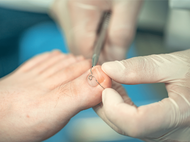 Multi-Clinic Podiatry Business for Sale in Greater London (P504)